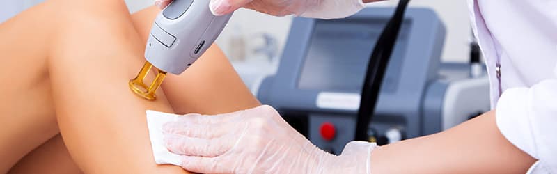 Depilação a laser: como funciona e quais são as vantagens